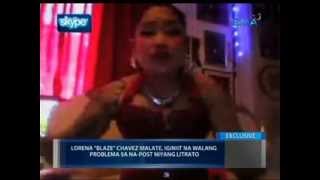 Saksi: Pilipinang nag-selfie kasama ang pasyenteng patay na, pinagmulta ng korte sa Switzerland