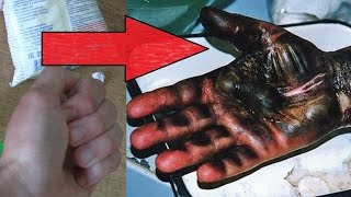 ЧТО БУДЕТ, ЕСЛИ СЖАТЬ В РУКЕ ЛЕД И СОЛЬ???