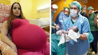 Mom Thinks She's Having Twins, But Drs Quickly Learn She's Making History With Rare Delivery