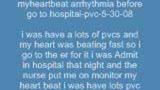 arrhythmia