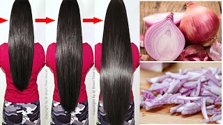 How To Grow Long and Thicken Hair Faster With Onion & Potato | Super fast Hair Growth Challenge