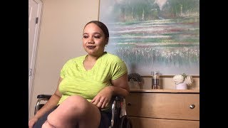 The Infection That Took Off My Foot| My Amputee Story