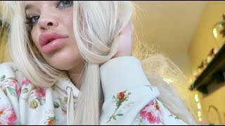 I'M ADDICTED TO LIP INJECTIONS! (NEW LIPS)