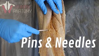 What Are "Pins & Needles"??