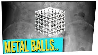 70 Magnetic Balls Had to Be Surgically Removed from Groin?!