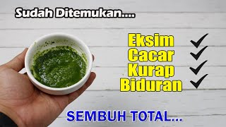 TIDAK PERLU KE DOKTER LAGI...!!! GATAL-GATAL DAN PENYAKIT.KULIT LAINNYA SEMBUH TOTAL