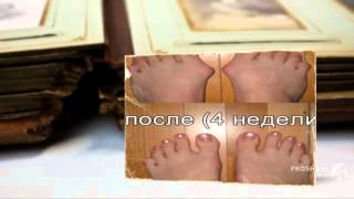 valgus pro в аптеках - Вальгус про недорого купить.