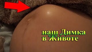 Невероятное Шевеление ребенка в животе 24-36 недели