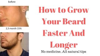 How To Grow Your Beard Faster And Longer || Beauty Tips Lab