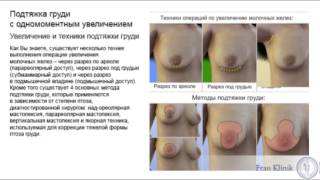 Подтяжка груди (мастопексия) с увеличением - Методики операции