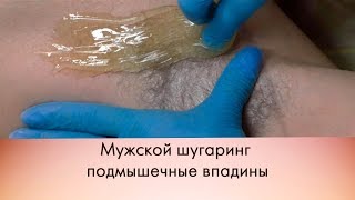 Мужской шугаринг подмышечные впадины