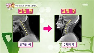 수건 한 장으로 '일자목' 고치는 방법! [엄지의 제왕 151회]