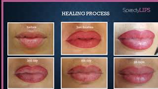 Speedy Lips - 22-23-24 Settembre Master Class in Belgrado