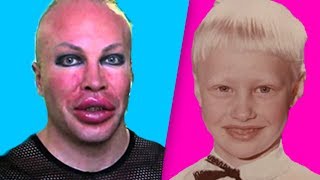 АЛЕКСАНДР ШПАК - ДО И ПОСЛЕ ОПЕРАЦИЙ, БИОГРАФИЯ, МАСЯ, УДАЛИЛ ЯЙЦА, ИНСТАГРАМ