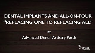 dental implants and All-on-four explained - Dr Adrian Kat