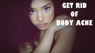 HOW TO : GET RID OF BODY ACNE