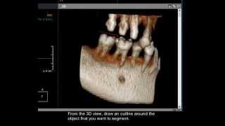3D Modeule: Segmentation