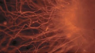 Regenerative medicine: an exciting new approach to stroke recovery