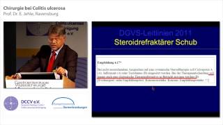 Chirurgie bei Colitis ulcerosa