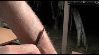 KNIFE SHARPENING FAIL! BLOODSHED! OUCH! Silver Stag