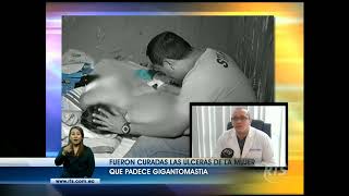 Fueron curadas las úlceras de la mujer que padece gigantomastia