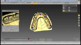 Overview of inLab SW 15