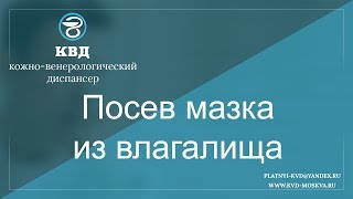296  Посев мазка из влагалища