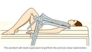 A cervical screening test - What can you expect?