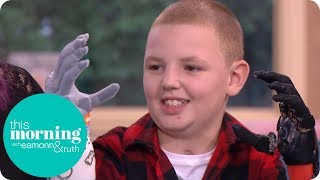 The 11-Year-Old Boy With the Bionic Hands | This Morning