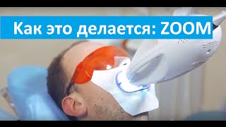 Как это делается? Zoom отбеливание. Процедура Zoom отбеливания в клинике Dr Stepman.