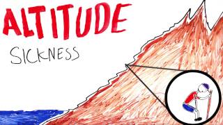What is Altitude Sickness ?