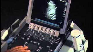 How to: Common Bile Duct Measurements with Ultrasound