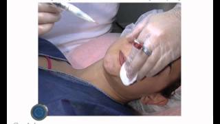 Permanent Make-up Lippen mit Holger Hoffmann powered by Goldeneye