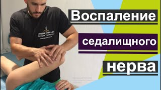 Воспаление седалищного нерва, работа с болью в области ягодиц и поясницы