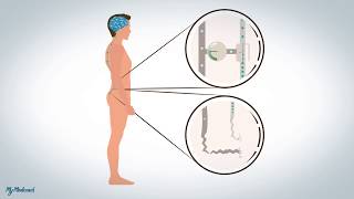 Douleurs neuropathiques et dysfonctionnelles: explication.