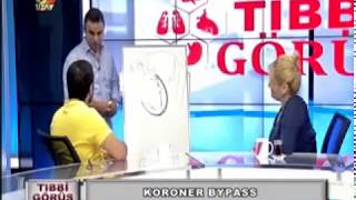 Kalp ameliyatı ekibi nedir ? - Prof. Dr. Ahmet AKGÜL
