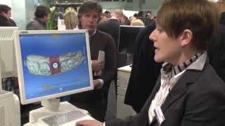 Sirona at IDS 2013: CEREC Software 4.2 - Chairside abutments