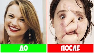 5 ЛЮДЕЙ, КОТОРЫЕ ПЕРЕЖИЛИ ВЫСТРЕЛ В ГОЛОВУ "БУДЬ В КУРСЕ" (16+)