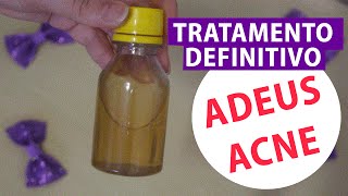 ? ACABE DE VEZ COM A ACNE Remédio Natural e Caseiro