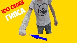 100 СЛОЕВ ГИПСА НА РУКУ | ЧЕЛЛЕНДЖ |  ОТОРВАЛО РУКУ | ЖЕСТЬ