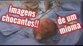 IMAGENS CHOCANTES DE UM MIOMA+COMO ME CUREI