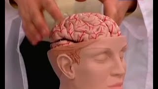 Инсульт - симптомы и причины, способы лечения. Первая помощь при инсульте