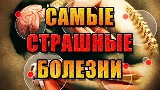 САМЫЕ СТРАШНЫЕ БОЛЕЗНИ (ШОК!!! 18+)