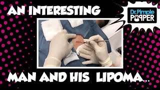 A Man as Interesting as his Lipoma