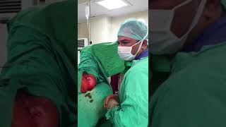 Living with Fistula concept Leaving Fistula untreated what will happen