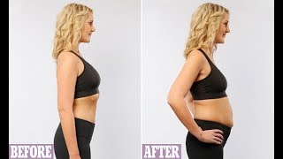 The slim women who say they bloat like a balloon