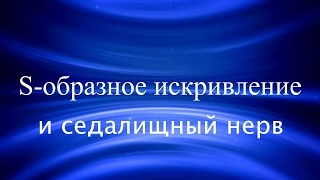 Защемление седалищного нерва. Возможные причины. Коррекция тренировки.