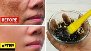 TETANGGA BANYAK YANG KAGET... FLEK HITAM MENAHUN RONTOK - CARA MENGATASI FLEK HITAM YANG MEMBANDEL