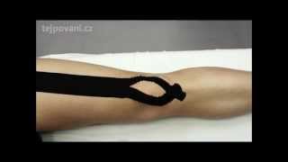 Tejpování předního stehenního svalu při bolesti kolene - kinesiotaping