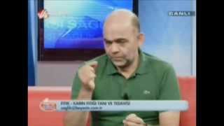 Göbek fıtığı (umbilikal herni) Prof. Yerdel